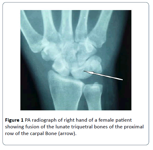 hsj-female-patient