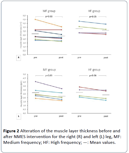 hsj-layer-thickness