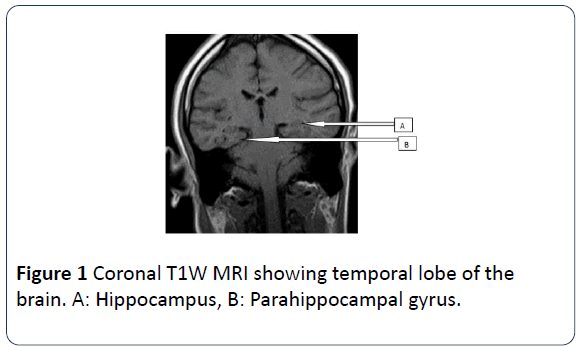 hsj-temporal-lobe