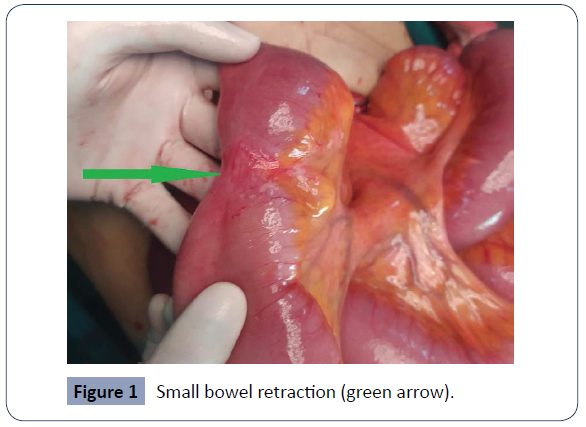 health-science-journal-bowel