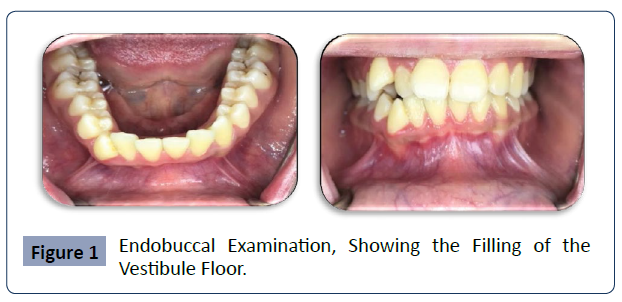 health-science-journal-Endobuccal