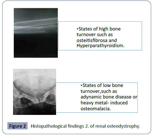 health-science-journal-Histopathological