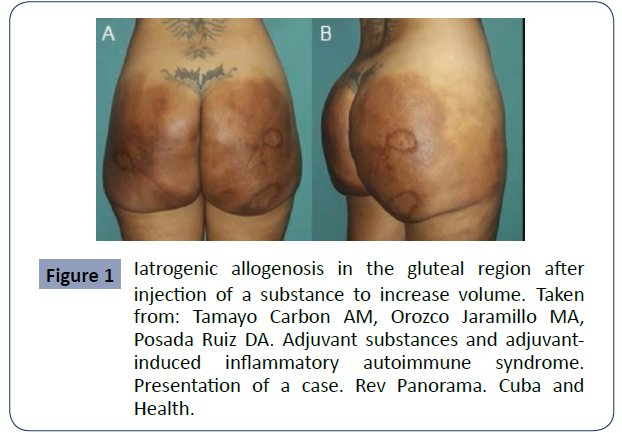 health-science-journal-Iatrogenic