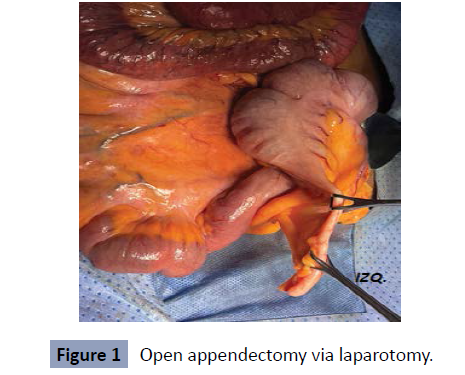 health-science-journal-appendectomy