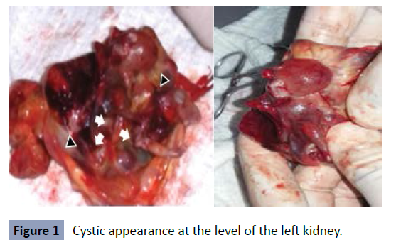 health-science-journal-cystic