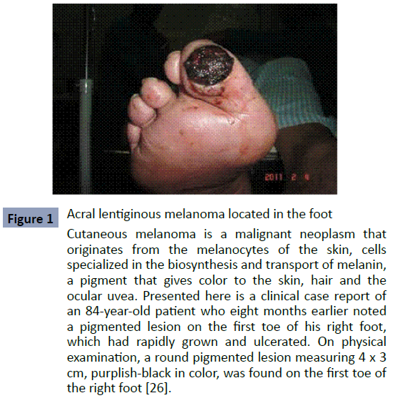 health-science-journal-lentiginous
