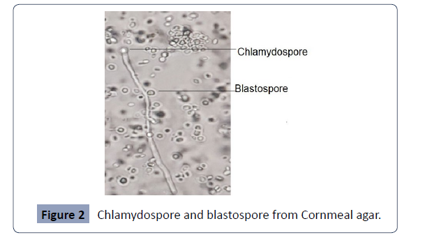 Health-Science-journal-Chlamydospore